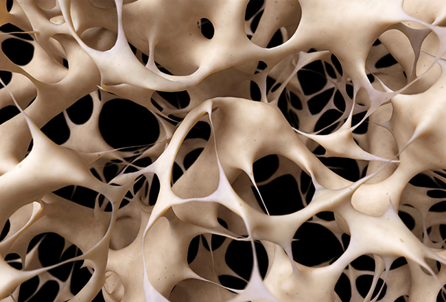 bone osteoporosis stamford health