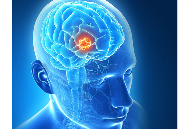 Sapience Therapeutics announces collaboration with University of Bath