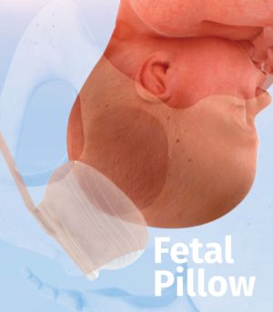 fetal pillow CooperSurgical