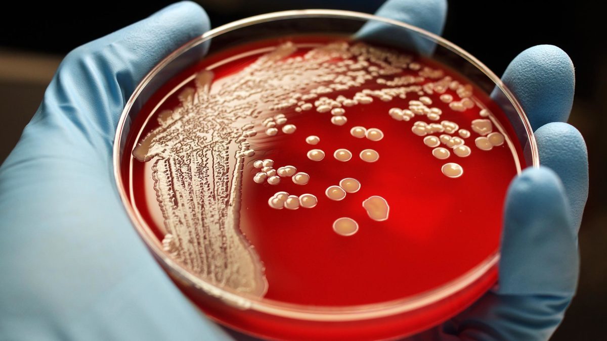 Yonkers company awarded $86.8M government contract for work on staph infections
