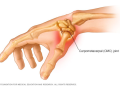 Middlesex Orthopedic & Spine Associates complete first in New England procedure