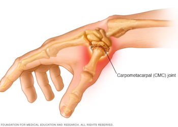 Middlesex Orthopedic & Spine Associates complete first in New England procedure