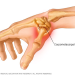 Middlesex Orthopedic & Spine Associates complete first in New England procedure